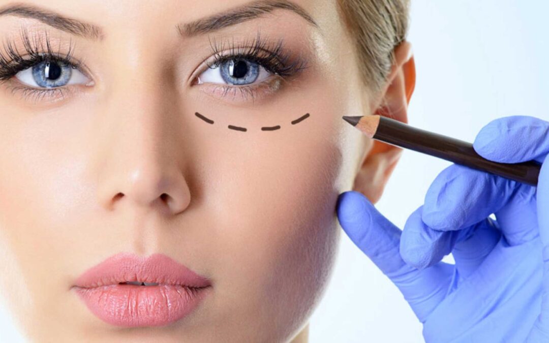 Rejuvenecimiento de mirada