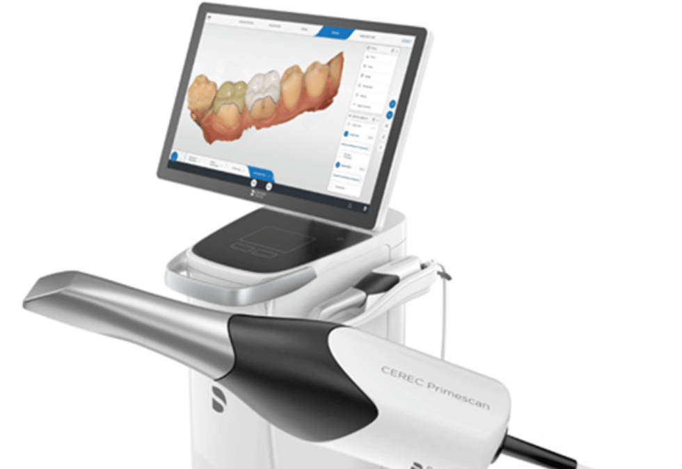 Escáner intraoral ¿Qué es y cuáles son sus ventajas?