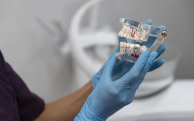 Historia y evolución de los implantes dentales